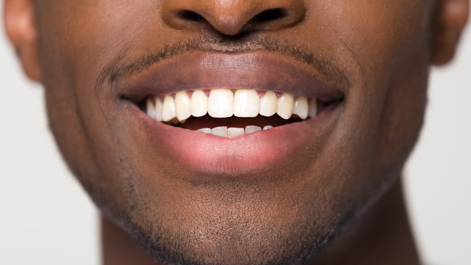A healthy adult smile — supported by good nutrition and care