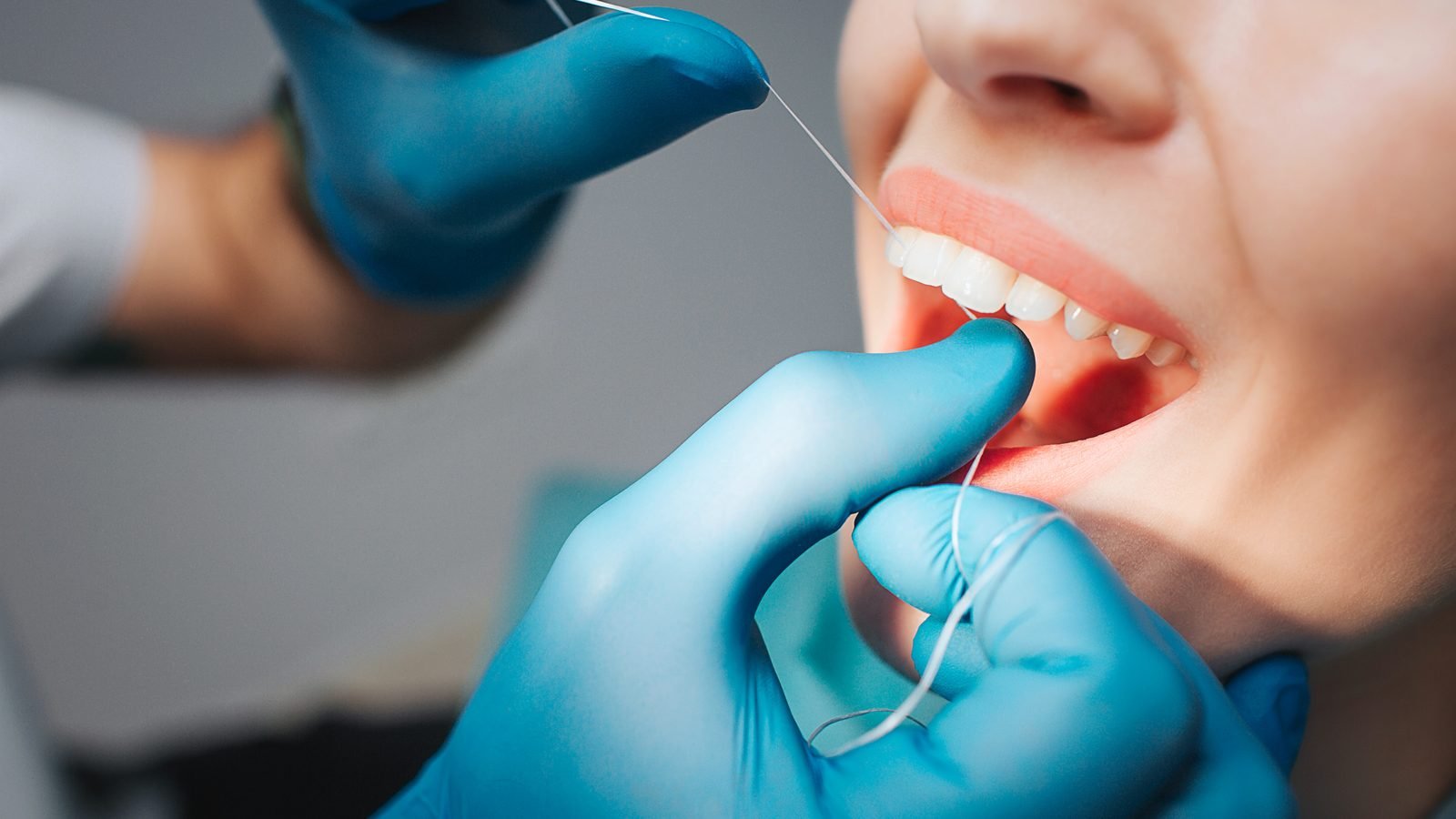 Professional dental flossing during a hygiene appointment