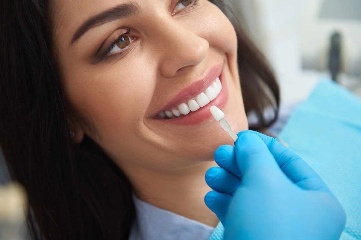 A relaxed patient smiling in the dental chair while the dentist matches a shade guide against her teeth